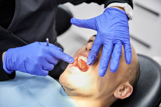 Best Walk-In Emergency Dentist in Cayuga, IN
